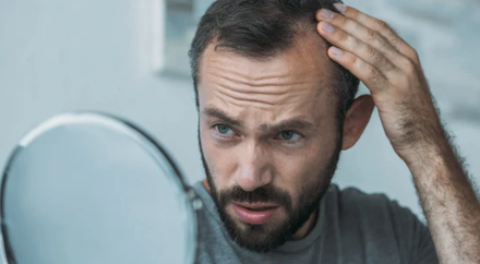 RECUPERA TU CONFIANZA: LAS CONSECUENCIAS DE LA CAÍDA DEL CABELLO